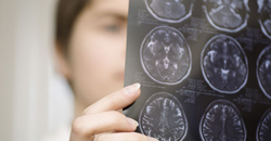 Una nueva tcnica revela bajo nivel de hierro cerebral en pacientes con TDAH